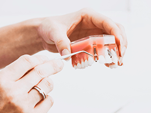 dentista-curitiba-implante-dentario