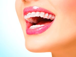 dentista-curitiba-ortodontia